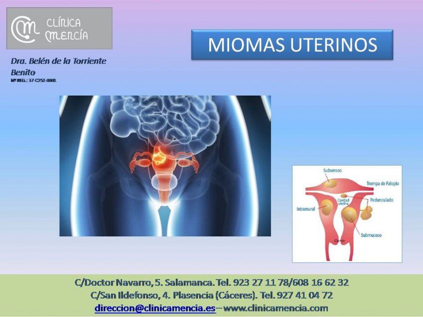 MIOMAS