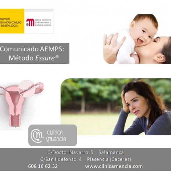 ESSURE RA (2)