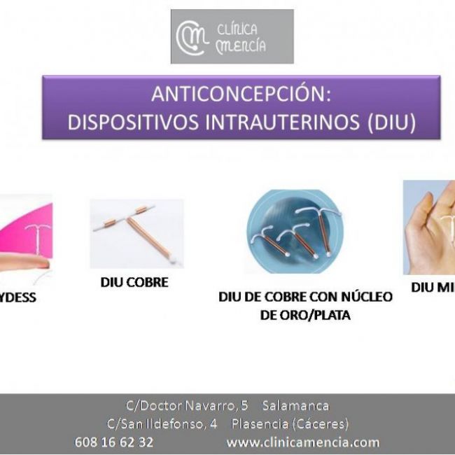 ANTICONCEPCIÓN. DIU