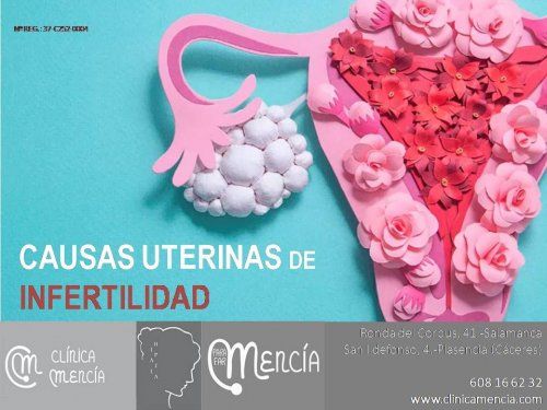 CAUSAS UTERINAS DE INFERTILIDAD